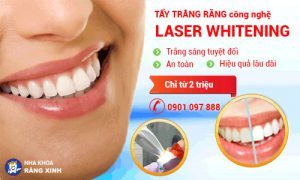 Tẩy trắng răng bằng công nghệ Laser White.