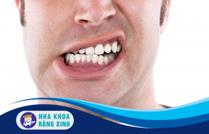 " Nghiến răng" căn bệnh tiềm ẩn nhiều nguy hiểm
