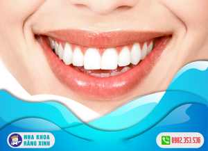 Nên bọc răng sứ hay trám răng khi bị sâu răng