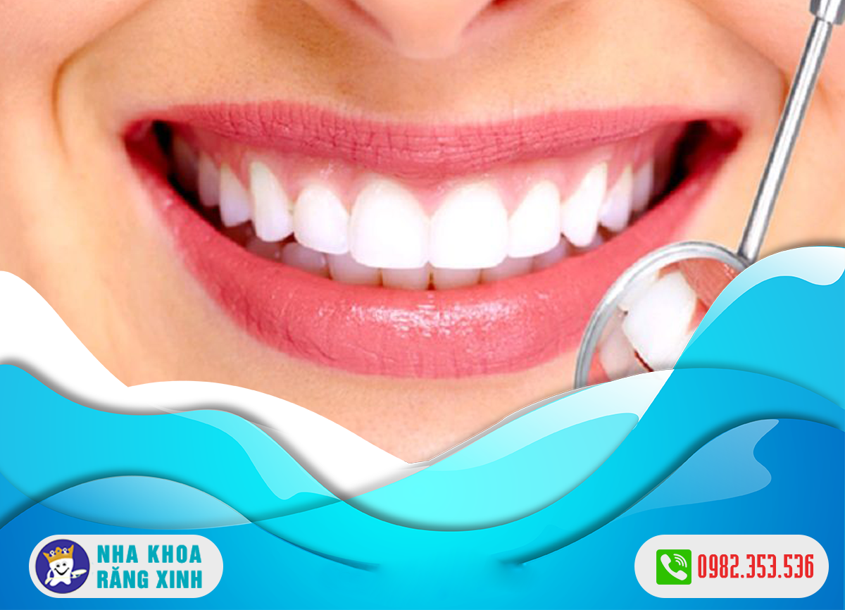 Nên bọc răng sứ hay trám răng khi bị sâu răng